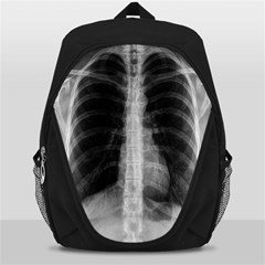 X Ray Backpack Bag by Valentinaart