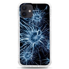 Neurons Brain Cells Structure Iphone 12 Mini Tpu Uv Print Case	 by anzea